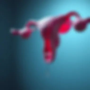 Schematic of intrauterine device placement