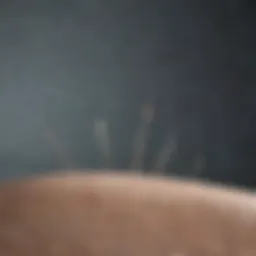 Acupuncture needles arranged on a serene background