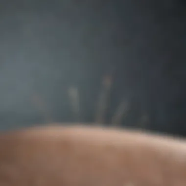 Acupuncture Points and Their Significance Acupuncture needles arranged on a serene background