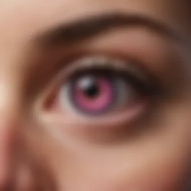 Management and Prevention of Pink Eye A diagram illustrating preventive measures and management strategies for pink eye