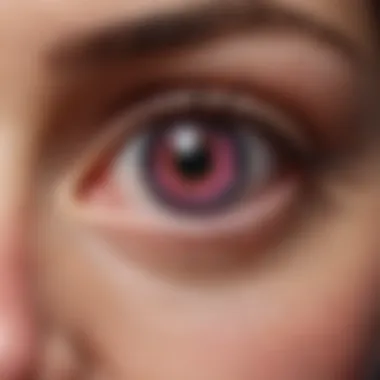 An illustration depicting the symptoms of pink eye including redness and swelling