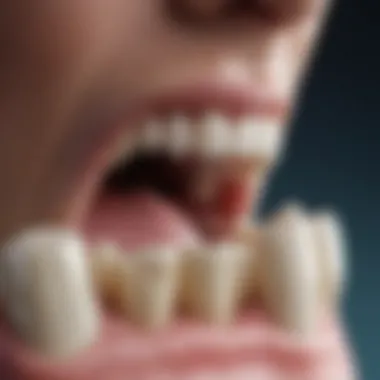 A close-up of a tooth with a modern restorative material applied.
