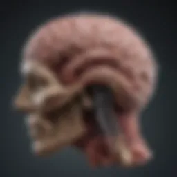 Visual representation of the brain affected by stroke