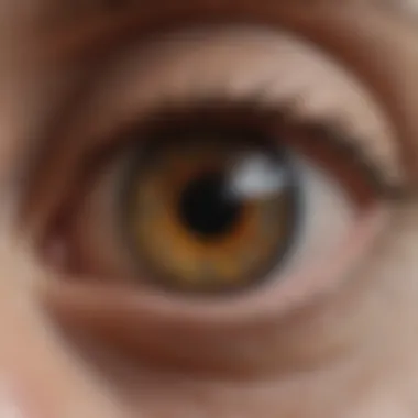 Age-Related Retinal Changes Age-related changes in retinal structure