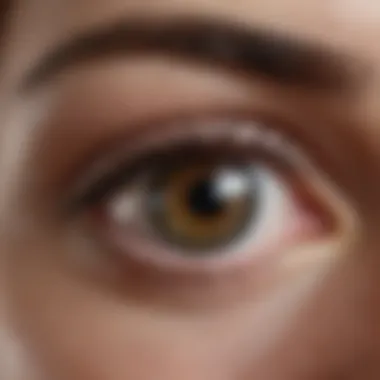 Common Conditions Leading to Eye Pressure Illustration of common conditions leading to eye pressure